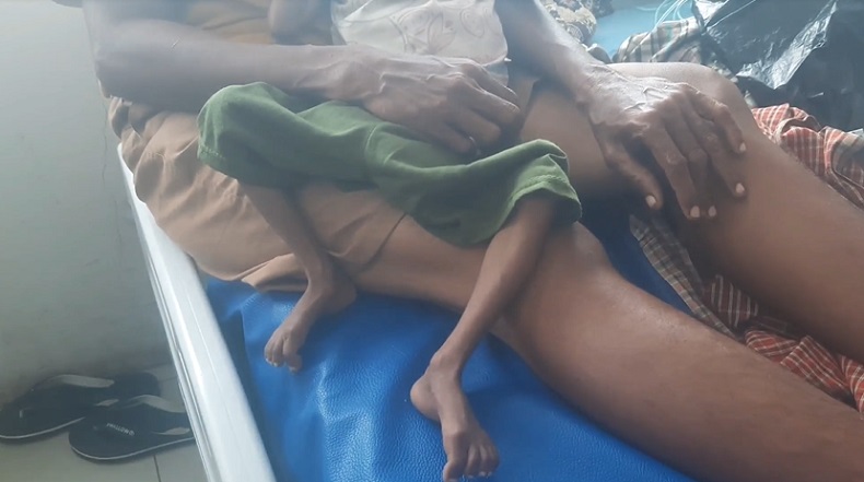 Terhimpit Ekonomi, Balita Gizi Buruk di Alor Baru Dirawat Setelah Dijemput Dinkes