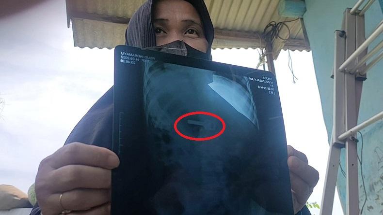 title Waduh, Bermain Sambil Tiduran, Bocah di Indramayu Tak Sengaja Telan Anak Kunci Waduh, Bermain Sambil Tiduran, Bocah di Indramayu Tak Sengaja Telan Anak Kunci