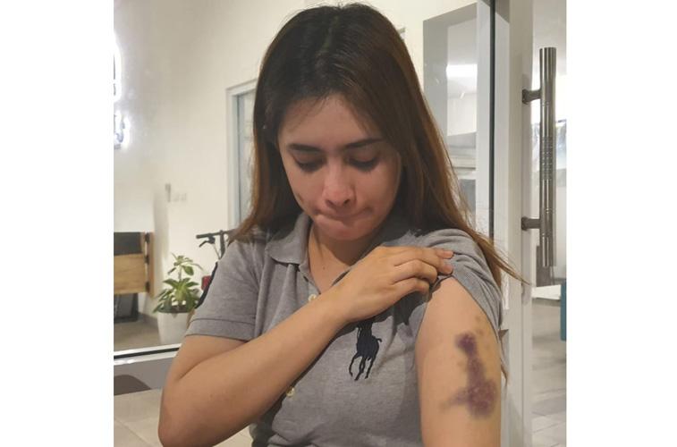 Buntut Kasus Penganiayaan, Pelapor Polwan Dilaporkan Balik terkait Kasus ITE