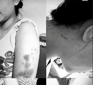 Pengakuan Korban Penganiayaan Polwan di Pekanbaru, Dijambak dan Disekap