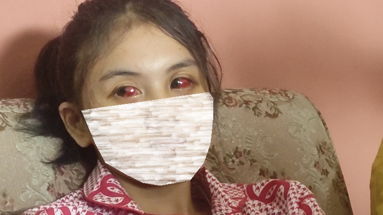 Pilu, Korban Tragedi Kanjuruhan Ini Hilang Ingatan Usai Koma 3 Hari, Matanya Memerah