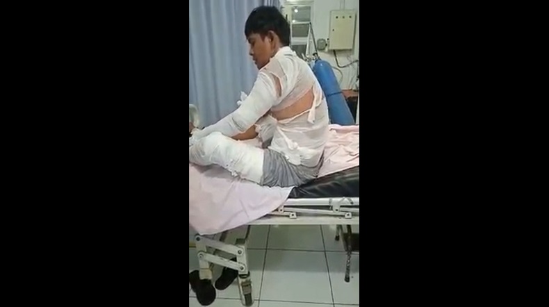 title Gerobak Ditabrak Pemotor, Tubuh Penjual Mi Ayam di Jember Melepuh Tersiram Air Panas Gerobak Ditabrak Pemotor, Tubuh Penjual Mi Ayam di Jember Melepuh Tersiram Air Panas