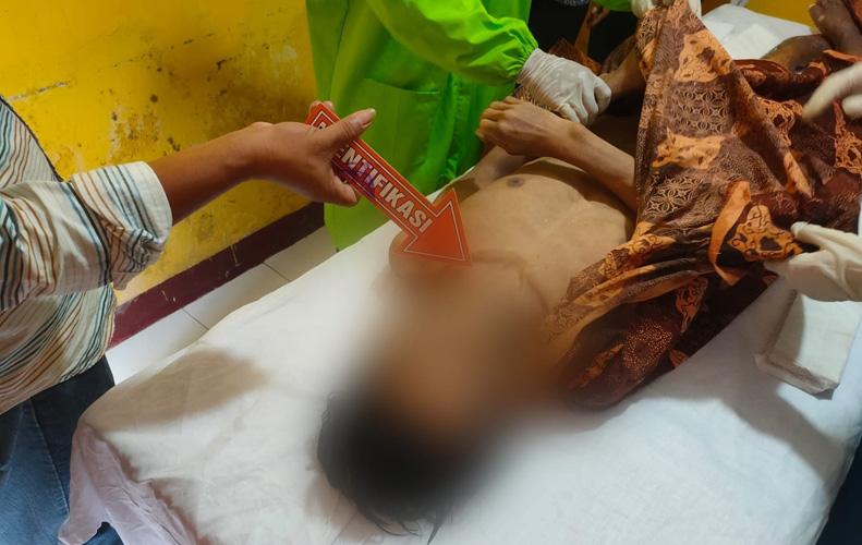  Ngeri, Warga Cilacap Diduga Bunuh Diri dengan Memotong Kedua Kakinya