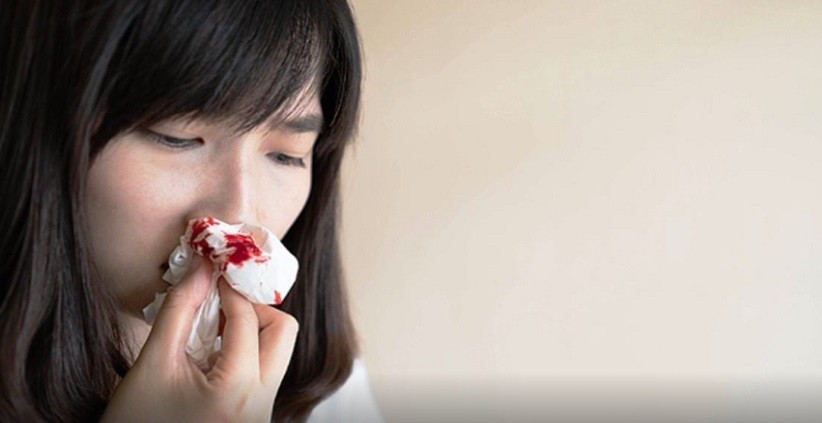 5 Cara Menghentikan Mimisan, Jangan Pernah Menyumpal Hidung!