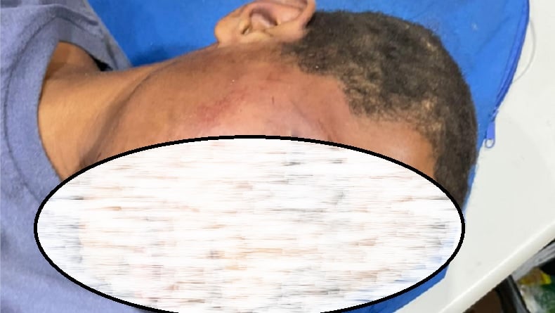title 3 Warga Dianiaya Oknum TNI AD, Diduga Ketahuan Curi Kakaktua Putih di Pos Prajurit 3 Warga Dianiaya Oknum TNI AD, Diduga Ketahuan Curi Kakaktua Putih di Pos Prajurit