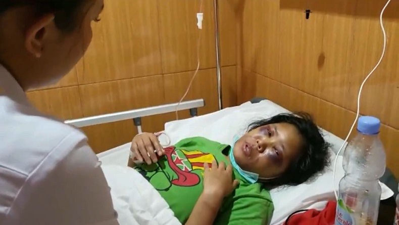 ART asal Garut Korban Penyiksaan Pasutri di Ngaprah KBB Trauma Berat