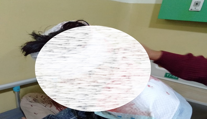 Kembali Berulah, Diduga Geng Motor Bacok Remaja usai Nonton Futsal di Cianjur