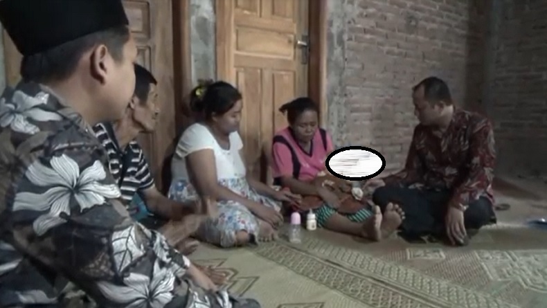 Bayi di Ponorogo Terlahir Tanpa Batok Kepala, Keluarga Tak Miliki Biaya Untuk Operasi 
