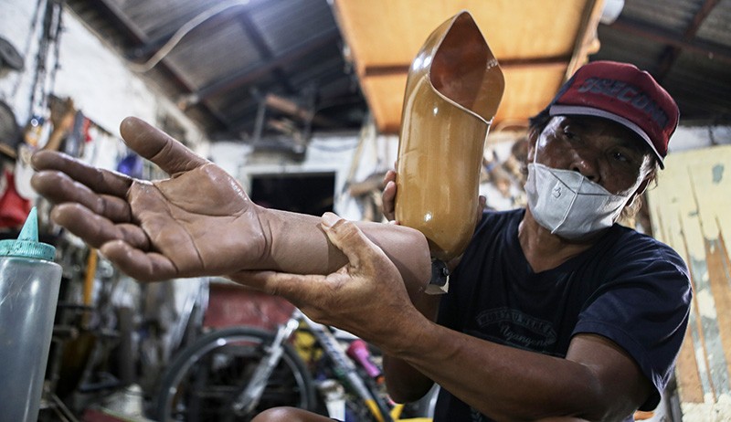 Pembuatan Tangan dan Kaki Palsu, Harga hingga Rp30 Juta - Bagian 2