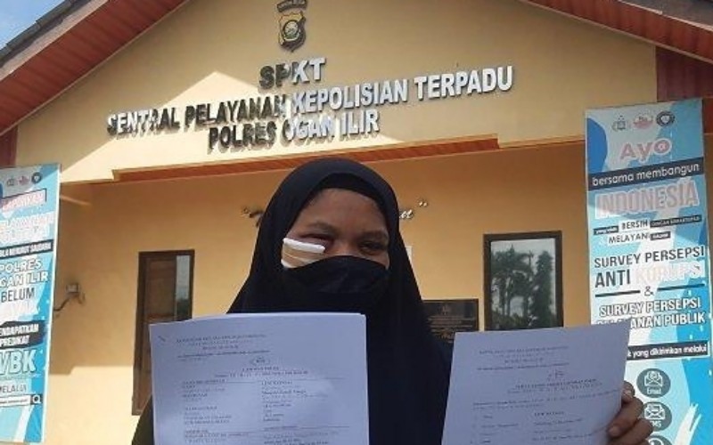 Dengan Muka Diperban, Ibu Muda Ini Laporkan Suami ke Polres Ogan Ilir