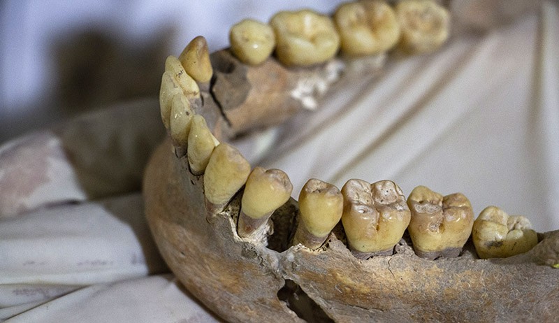 Konservasi Kerangka Manusia Purba Berusia 7.200 Tahun - Bagian 2