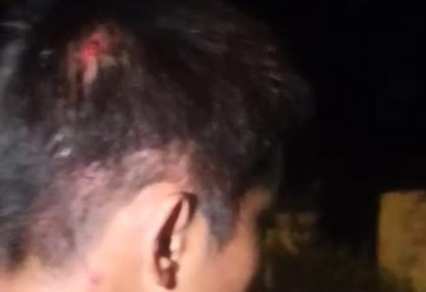 Saling Kejar, Remaja Asal Bantul Alami Luka di Kepala Diduga Terkena Airsoft Gun