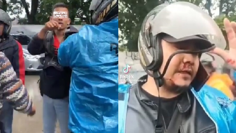 Pria di Baleendah Bandung Dipukul Debt Collector, Bibir dan Hidung Terluka