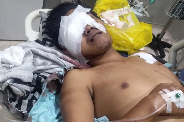 title Warga Mestong Jambi Luka Parah Diserang Beruang saat Berada di Kebun Warga Mestong Jambi Luka Parah Diserang Beruang saat Berada di Kebun