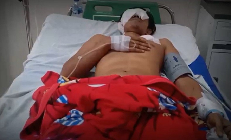 title Petani Karet di Muaro Jambi Diserang Beruang, Wajahnya Dicakar Kini Terancam Buta Petani Karet di Muaro Jambi Diserang Beruang, Wajahnya Dicakar Kini Terancam Buta