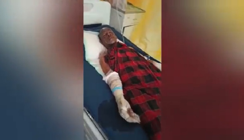 title Tabung Elpiji Meledak di Banyuwangi, 4 Orang Sekeluarga Luka Bakar Serius Tabung Elpiji Meledak di Banyuwangi, 4 Orang Sekeluarga Luka Bakar Serius