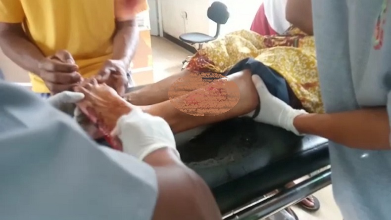title 5 Warga Lombok Timur Diserang Monyet, 1 Luka Parah di Kaki 5 Warga Lombok Timur Diserang Monyet, 1 Luka Parah di Kaki