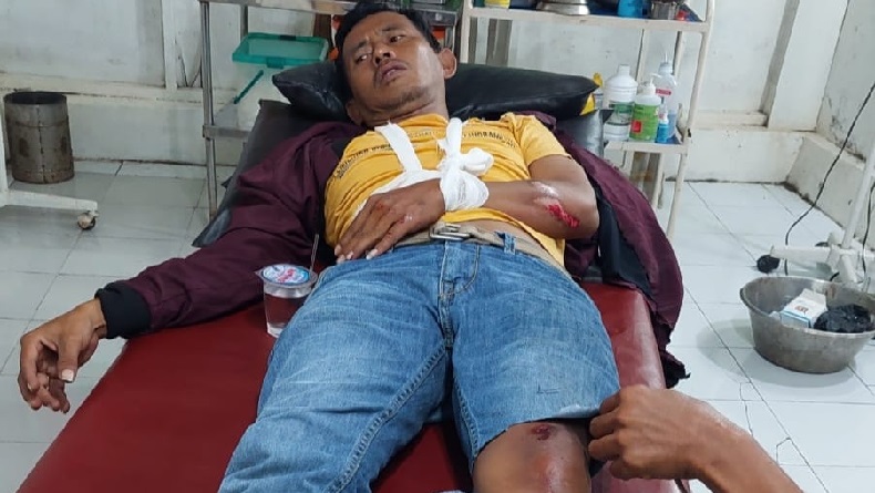 Wartawan di Indramayu Terluka Parah akibat Jadi Korban Tabrak Lari di Jatibarang