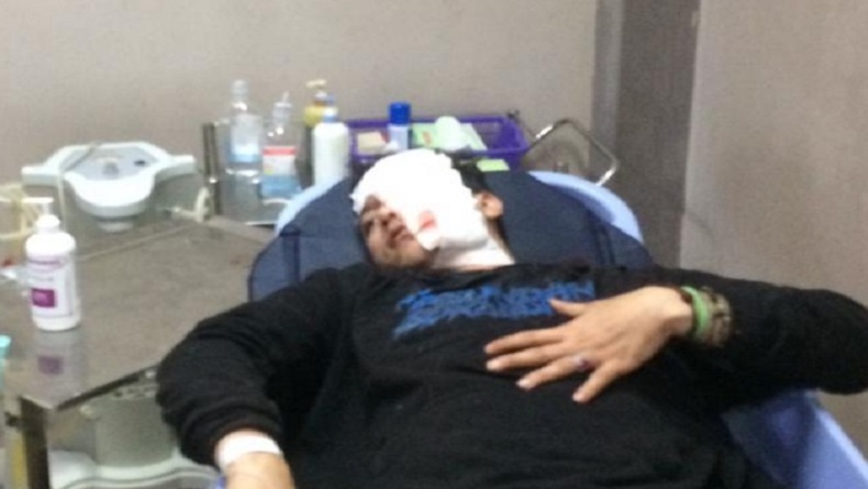 Kronologi Pembacokan Anggota Brigez Sukabumi, Korban Kenal Pelaku