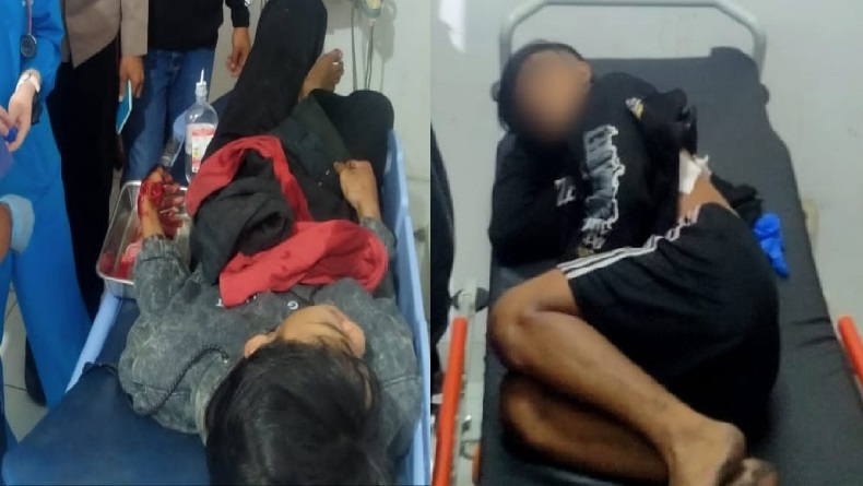 Sukabumi Geger, 2 Pemuda Terkapar Dibacok Geng Motor di Jalan Pondok Halimun