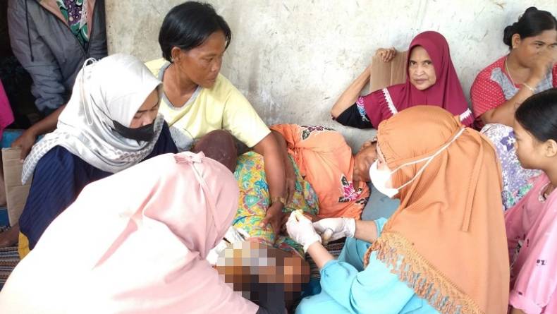 Kisah Nenek Nurung, Selamat setelah Bertarung Lawan Buaya, Dapat 76 Jahitan di Kaki 