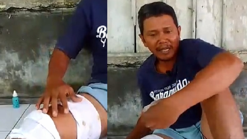 Duel dengan Buaya, Warga Pandeglang Nyaris Tewas, Lolos usai Colok Mata Sang Predator