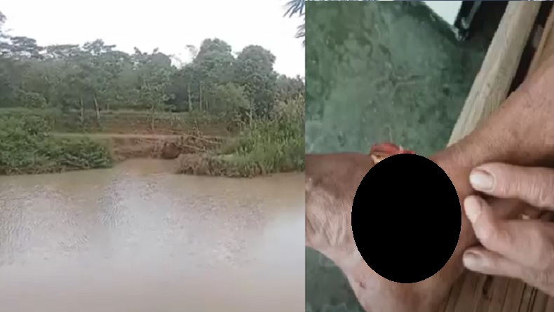 Warga Pandeglang Kembali Jadi Korban Gigitan Buaya, Kaki Luka Robek
