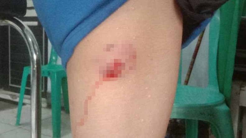 title 20 Warga Timor Tengah Selatan Terjangkit Rabies usai Digigit Anjing, 1 Tewas 20 Warga Timor Tengah Selatan Terjangkit Rabies usai Digigit Anjing, 1 Tewas
