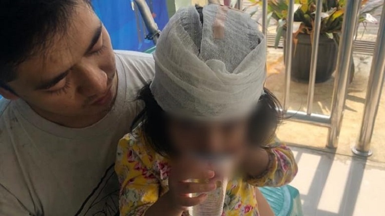 Nahas, Kepala Balita Luka Parah Tertimpa Timbangan di Posyandu Baros Sukabumi