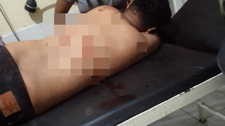 Asyik Nonton Organ Tunggal, Pria di Lampung Selatan Tewas Dikeroyok