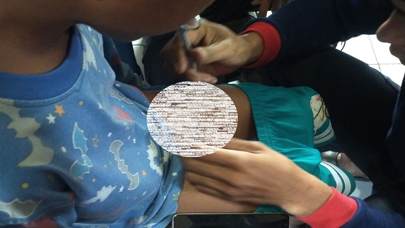 Gegara Kemaluan Terjepit Ritsleting Berjam-jam, Bocah Dievakuasi ke Damkar Cimahi