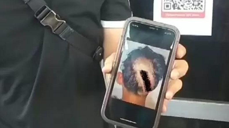 Diadang Puluhan Pemuda, Pelajar SMA di Palembang Nyaris Tewas Usai Kepalanya Dibacok