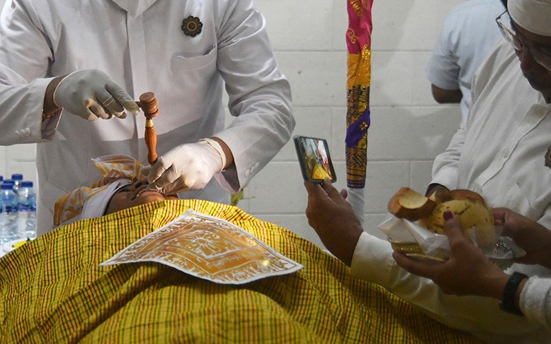 Ngilu, Melihat 70 Remaja Potong Gigi Massal - Bagian 1