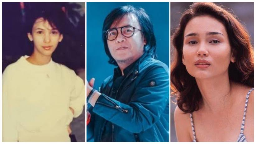 Deretan Artis Lawas Penyintas Kanker Ada Yang Rela Kehilangan Rambut