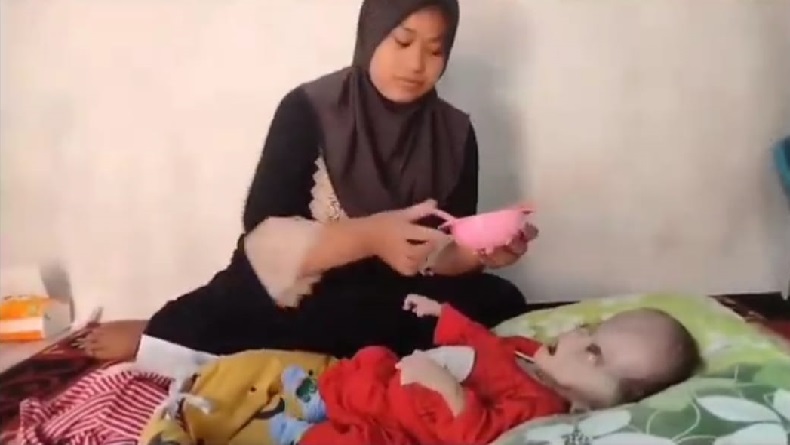 Pilu, Bayi 8 Bulan di Tasikmalaya Derita Hidrosefalus, Butuh Uluran Tangan Dermawan