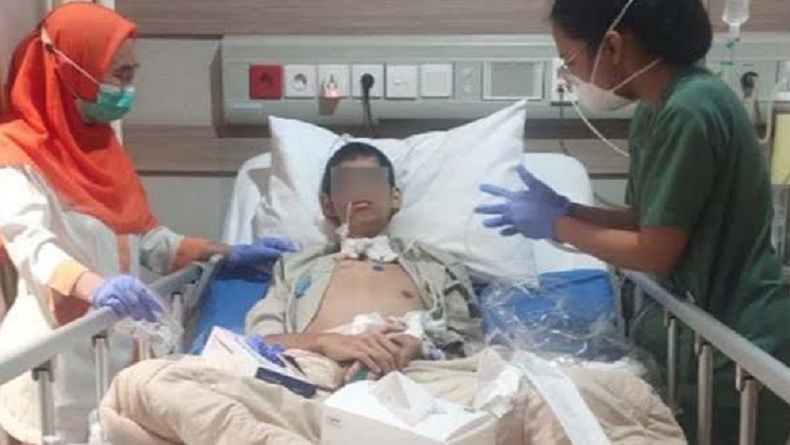 Mahasiswa Unbraw asal Jakarta Luka Parah Terjerat Kabel Fiber Optik, Kondisinya Memprihatinkan