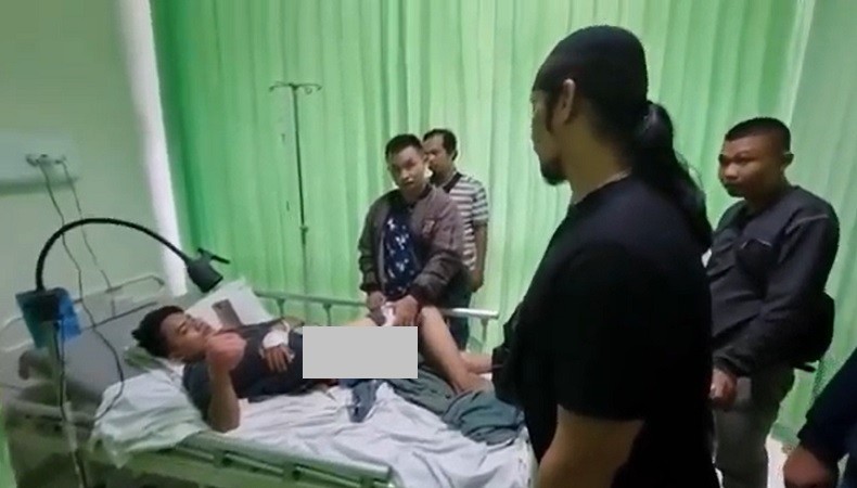 Pengendara Motor Ditebas Jarinya hingga Putus gegara Abaikan Klakson Mobil