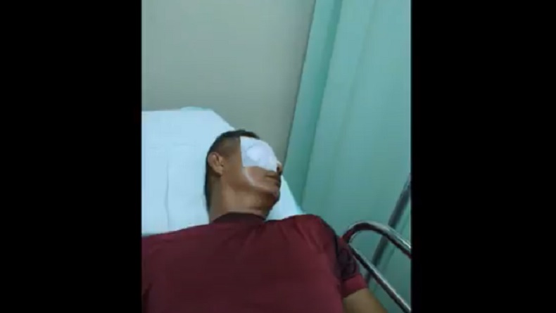 Guru Dikatapel Wali Murid hingga Mata Luka, Motif Tak Terima Anak Ditegur saat Merokok