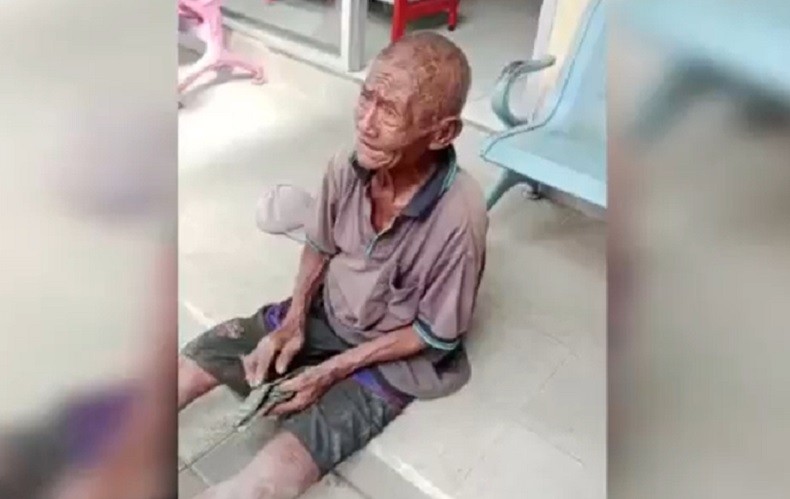 Viral Kakek 71 Tahun di Bali Dijambret hingga Terseret Motor, Uang Rp700.000 Lenyap