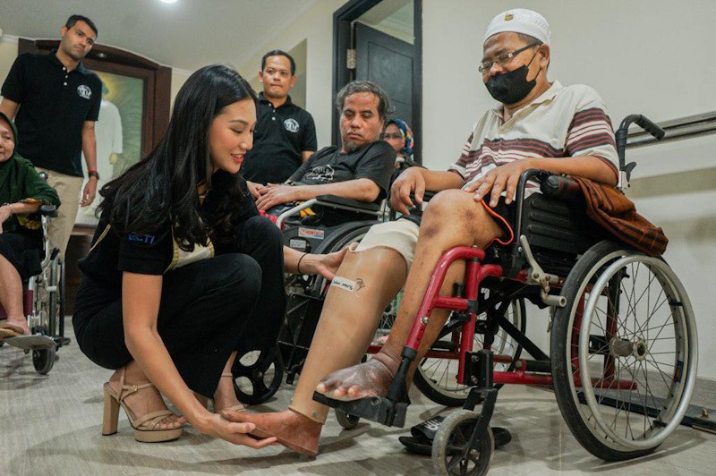 Momen Miss Indonesia 2022 Audrey Vanessa Bantu Pasangkan Kaki Palsu dari MNC Peduli - Bagian 1