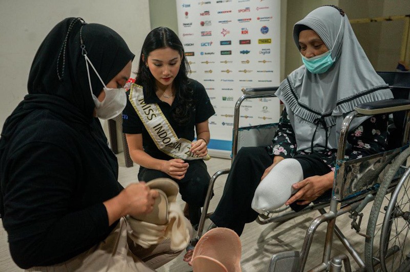 Momen Miss Indonesia 2022 Audrey Vanessa Bantu Pasangkan Kaki Palsu dari MNC Peduli - Bagian 4