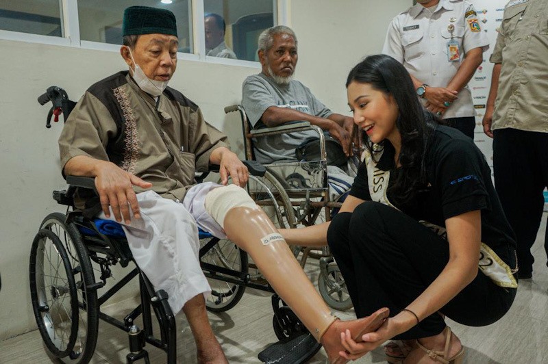 Momen Miss Indonesia 2022 Audrey Vanessa Bantu Pasangkan Kaki Palsu dari MNC Peduli - Bagian 2