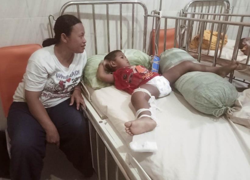 Nestapa Fali Rabbani, Balita Sebatang Kara Penderita Patah Tulang di Jember: Terabaikan meski Tinggal Dekat Pusat Kekuasaan