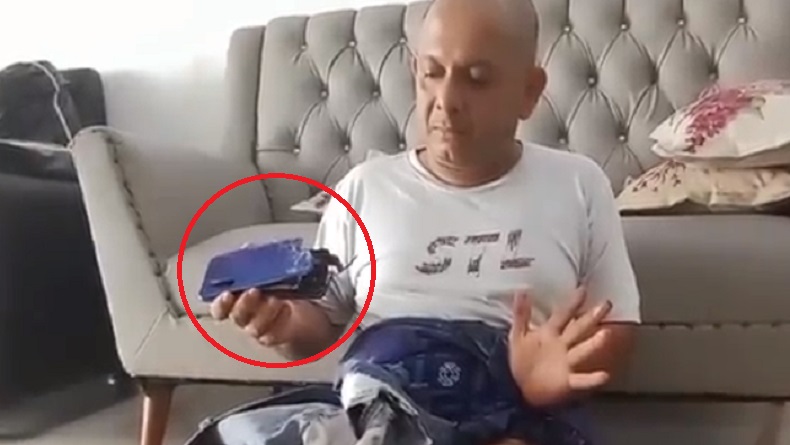 Ngeri, HP Meledak Dalam Saku Celana, Warga Asahan Luka Bakar di Kaki dan Tangan