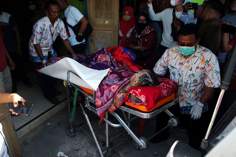 Penyakit Langka Diderita Bocah Asal Desa Sukareja Tegal, Sekujur Tubuh Melepuh - Bagian 1