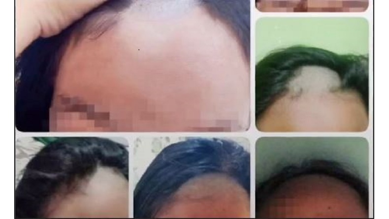Siswi SMP di Lamongan Trauma Seusai Dibotaki, Partai Perindo: Setop Kekerasan di Sekolah!