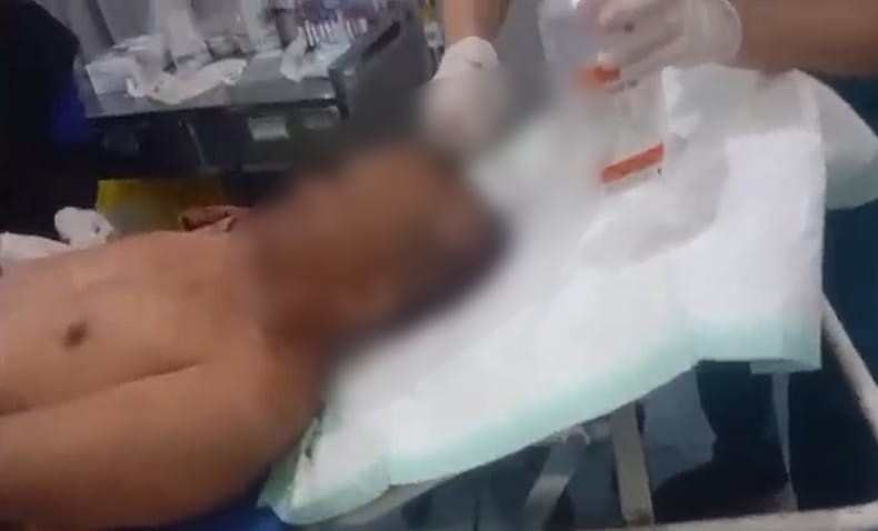 Pria Palembang Kritis usai Ditembak di Kepala, Pelaku Teman Sendiri 