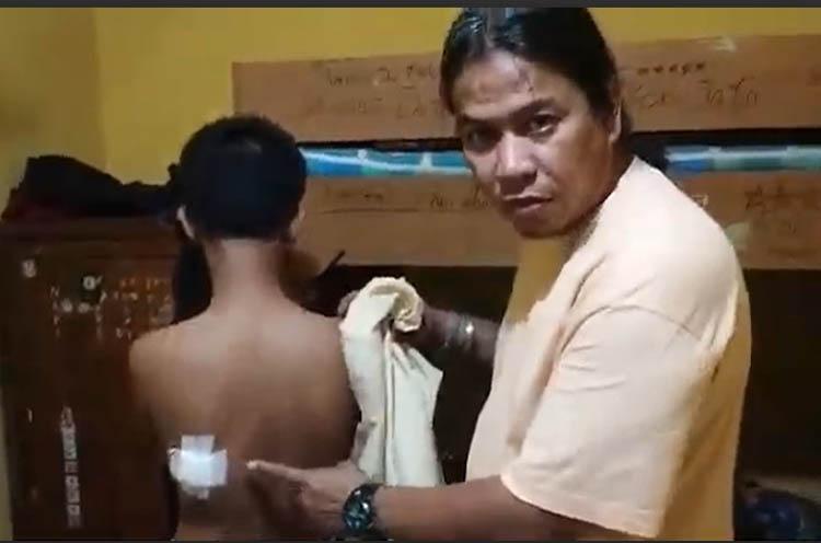 Dendam Tawuran, Pelajar di Padang Bacok Siswa Sekolah Lain