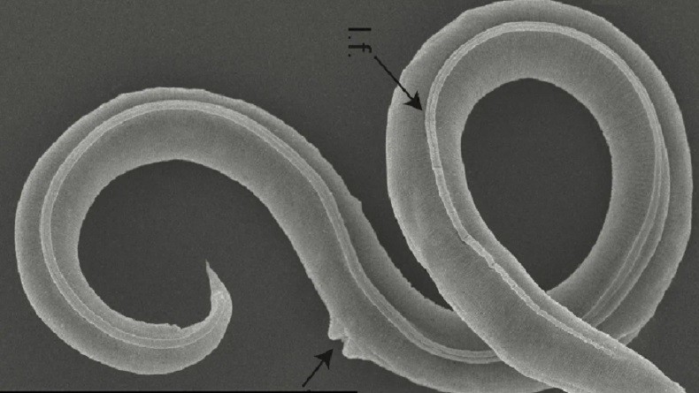Mampu Bertahan Di Lingkungan Ekstrem Cacing Purba Hidup Kembali