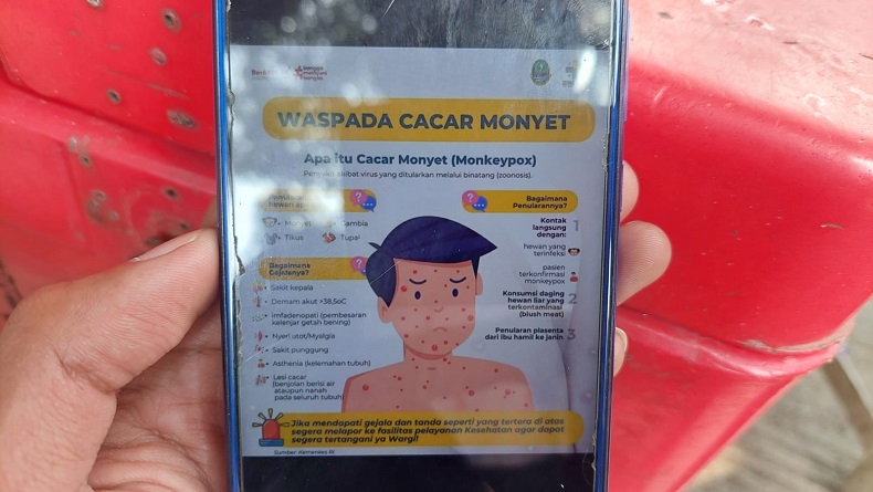 Dinkes Cimahi Siagakan Puskesmas Usai Kasus Cacar Monyet Muncul di Kota Bandung